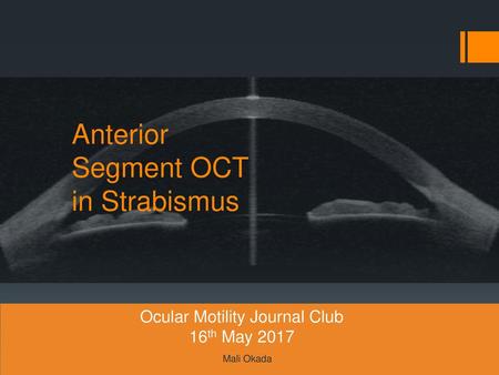 Anterior Segment OCT in Strabismus