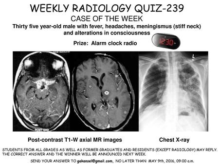 WEEKLY RADIOLOGY QUIZ-239