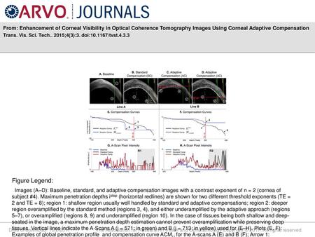 From: Enhancement of Corneal Visibility in Optical Coherence Tomography Images Using Corneal Adaptive Compensation Trans. Vis. Sci. Tech.. 2015;4(3):3.