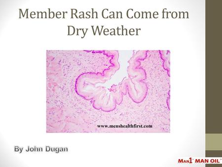 Member Rash Can Come from Dry Weather