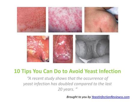 10 Tips You Can Do to Avoid Yeast Infection