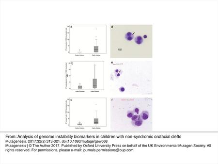 Figure 1. Genomic instability biomarkers in non-syndromic cleft lip and/or palate patients and control children. Frequency of MN (a), nucleoplasmic bridges.