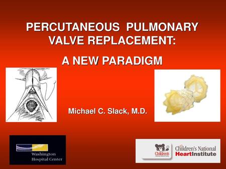 PERCUTANEOUS PULMONARY VALVE REPLACEMENT: