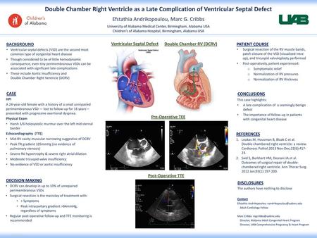 Ventricular Septal Defect Double Chamber RV (DCRV)