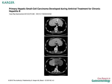 Case Rep Gastroenterol 2015;9: DOI: /