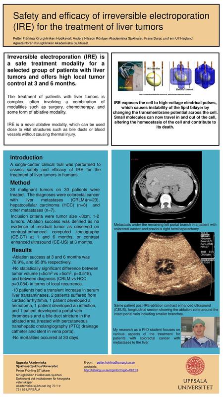 Safety and efficacy of irreversible electroporation (IRE) for the treatment of liver tumors Petter Frühling Kirurgkliniken Hudiksvall, Anders Nilsson Röntgen.