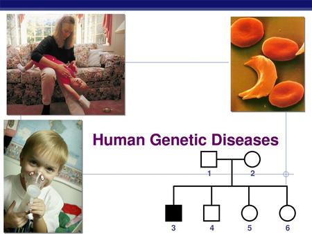 Human Genetic Diseases