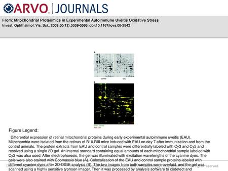 Invest. Ophthalmol. Vis. Sci ;50(12): doi: /iovs Figure Legend: