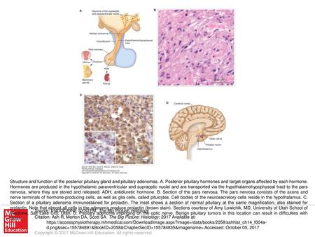 Structure and function of the posterior pituitary gland and pituitary adenomas. A. Posterior pituitary hormones and target organs affected by each hormone.