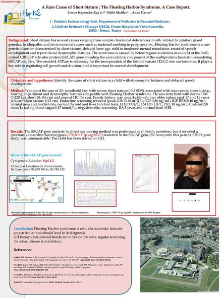 ESPE2015/P3-1048                                A Rare Cause of Short Stature : The Floating Harbor Syndrome. A Case Report.