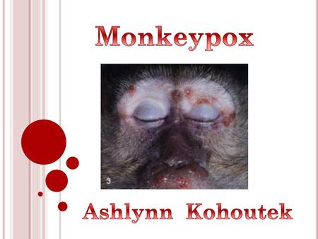 Monkeypox Ashlynn Kohoutek.