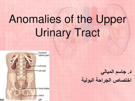 Anomalies of the Upper Urinary Tract