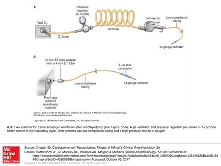 A,B: Two systems for transtracheal jet ventilation after cricothyrotomy (see Figure 55-5). A jet ventilator and pressure regulator (as shown in A) provide.