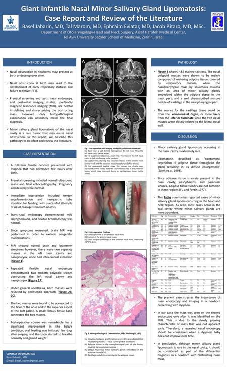 Giant Infantile Nasal Minor Salivary Gland Lipomatosis: Case Report and Review of the Literature Basel Jabarin, MD, Tal Marom, MD, Ephraim Eviatar, MD,