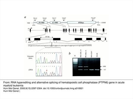 Figure 1. RT–PCR identification of an abnormal transcript of the PTPN6 gene in normal and leukemic bone marrow cells and cell line. (a) Diagrammatic representation.