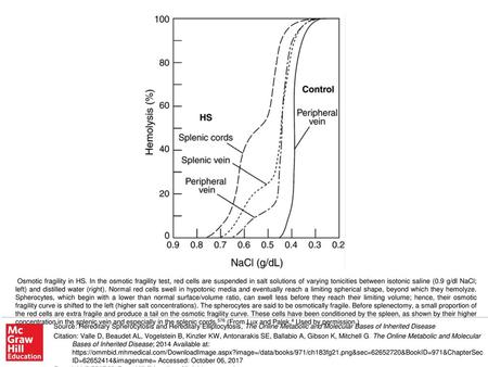 Osmotic fragility in HS