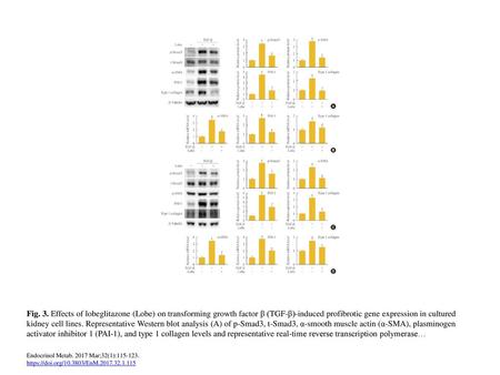 Fig. 3. Effects of lobeglitazone (Lobe) on transforming growth factor β (TGF-β)-induced profibrotic gene expression in cultured kidney cell lines. Representative.