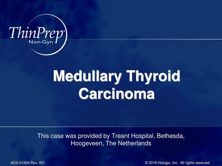 Medullary Thyroid Carcinoma