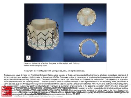 Percutaneous valve devices