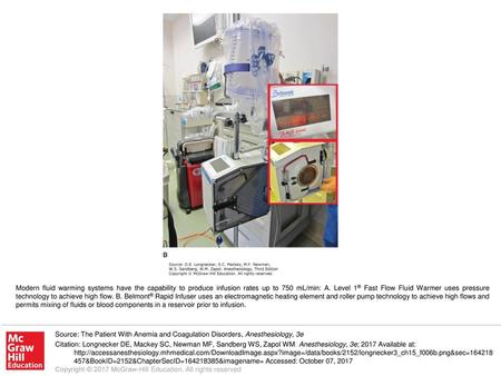 Modern fluid warming systems have the capability to produce infusion rates up to 750 mL/min: A. Level 1® Fast Flow Fluid Warmer uses pressure technology.