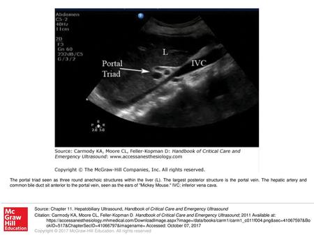 The portal triad seen as three round anechoic structures within the liver (L). The largest posterior structure is the portal vein. The hepatic artery and.