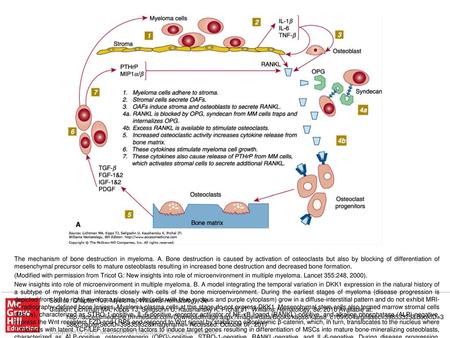 New insights into role of microenvironment in multiple myeloma. B