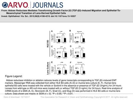 From: Aldose Reductase Mediates Transforming Growth Factor β2 (TGF-β2)–Induced Migration and Epithelial-To-Mesenchymal Transition of Lens-Derived Epithelial.