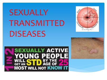 SEXUALLY TRANSMITTED DISEASES