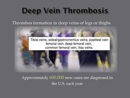 Deep Vein Thrombosis Thrombus formation in deep veins of legs or thighs Tibial veins, soleal/gastrocnemius veins, popliteal vein femoral vein, deep femoral.