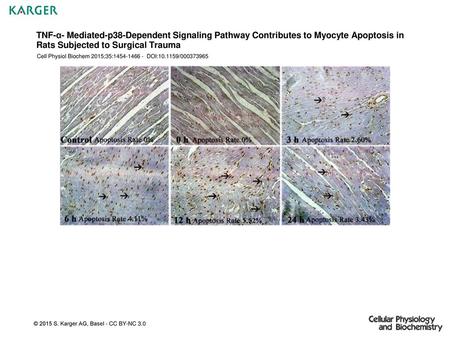 TNF-α- Mediated-p38-Dependent Signaling Pathway Contributes to Myocyte Apoptosis in Rats Subjected to Surgical Trauma Cell Physiol Biochem 2015;35:1454-1466.