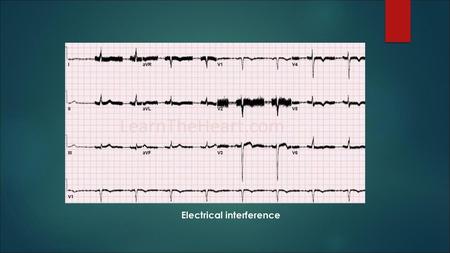 Electrical interference