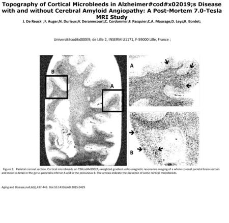 Topography of Cortical Microbleeds in Alzheimer#cod#x02019;s Disease with and without Cerebral Amyloid Angiopathy: A Post-Mortem 7.0-Tesla MRI Study J.