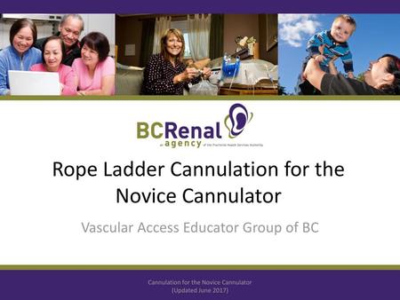 Rope Ladder Cannulation for the Novice Cannulator