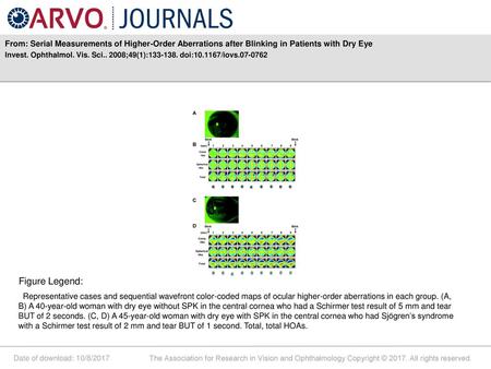 Invest. Ophthalmol. Vis. Sci ;49(1): doi: /iovs Figure Legend: