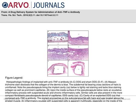 From: A Drug Delivery System for Administration of Anti–TNF-α Antibody