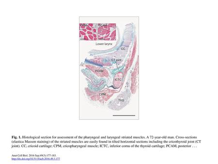 Fig. 1. Histological section for assessment of the pharyngeal and laryngeal striated muscles. A 72-year-old man. Cross-sections (elastica Masson staining)