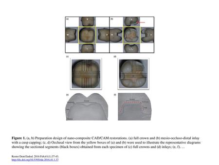 Figure 1. (a, b) Preparation design of nano-composite CAD/CAM restorations. (a) full crown and (b) mesio-occluso-distal inlay with a cusp capping; (c,