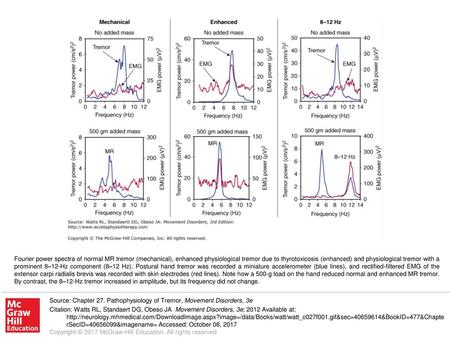 Fourier power spectra of normal MR tremor (mechanical), enhanced physiological tremor due to thyrotoxicosis (enhanced) and physiological tremor with a.