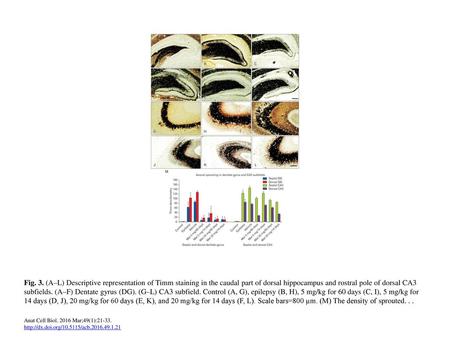 Fig. 3. (A–L) Descriptive representation of Timm staining in the caudal part of dorsal hippocampus and rostral pole of dorsal CA3 subfields. (A–F) Dentate.