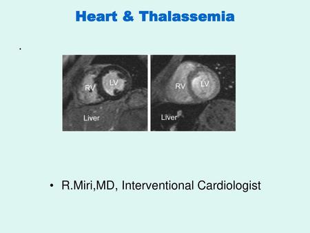 Heart & Thalassemia . R.Miri,MD, Interventional Cardiologist.