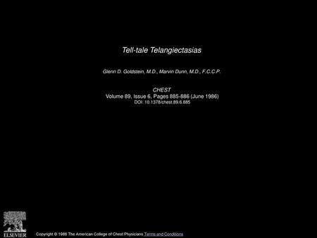 Tell-tale Telangiectasias