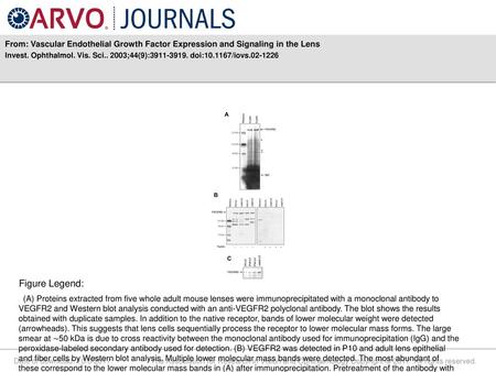 Invest. Ophthalmol. Vis. Sci ;44(9): doi: /iovs Figure Legend: