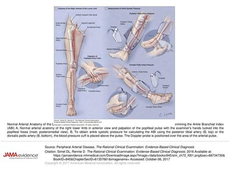 Normal Arterial Anatomy of the Lower Limb and Positioning for Measurement of Ankle Systolic Pressure Used for Determining the Ankle Branchial Index (ABI)