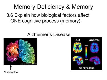 Memory Deficiency & Memory