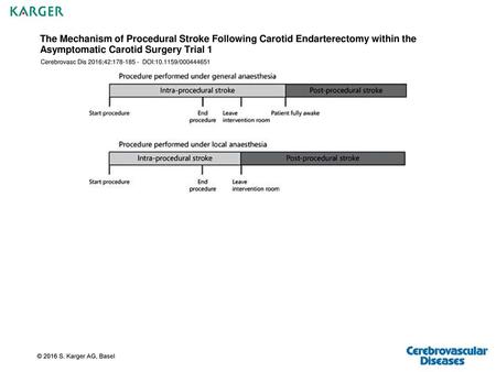 The Mechanism of Procedural Stroke Following Carotid Endarterectomy within the Asymptomatic Carotid Surgery Trial 1 Cerebrovasc Dis 2016;42:178-185 -