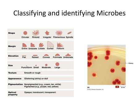 Classifying and identifying Microbes