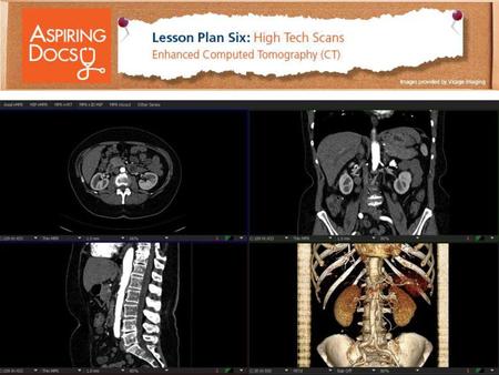 Computed Tomography with Reconstructions and Volume Rendering