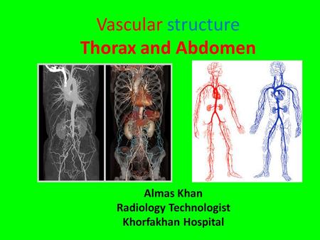 Vascular structure Thorax and Abdomen Almas Khan Radiology Technologist Khorfakhan Hospital.