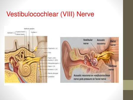 Vestibulocochlear (VIII) Nerve