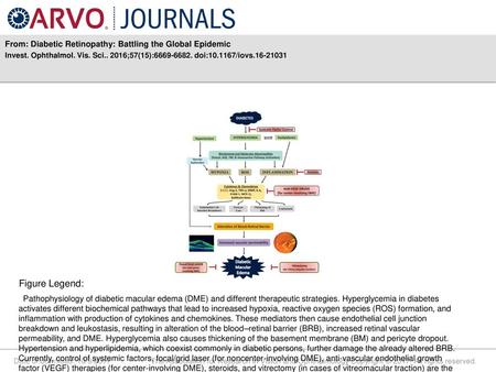 From: Diabetic Retinopathy: Battling the Global Epidemic